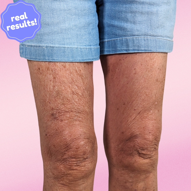 Sculvia™ Sculpt Strips