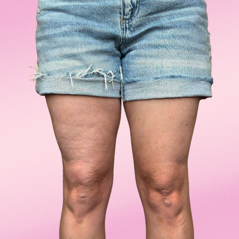 Sculvia™ Sculpt Strips